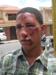 RD: Policías golpean joven porque no lo dejó bailar con una prima en Hato Mayor 