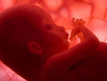 Video: Condiciones para que mujer durara 30 años con feto en su vientre