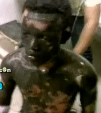 Video: Hombre se Prendió en Fuego