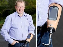 Implantó un smartphone en su brazo